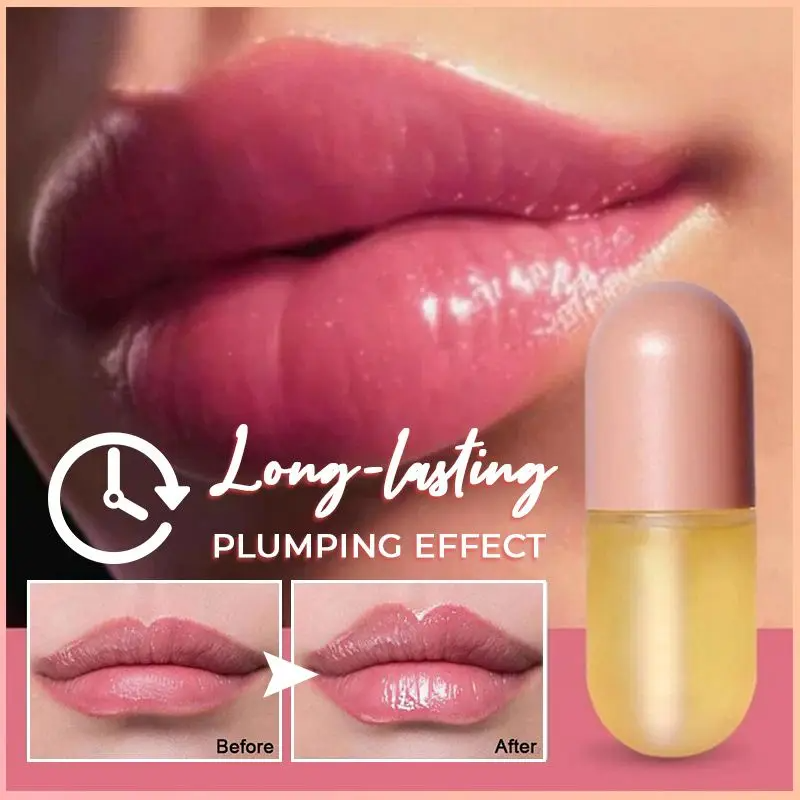 Natuurlijke vollere lippen | Veilig en revolutionair - Viyan