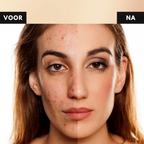 Tricolor concealer palet | Verberg huidimperfecties - Marli